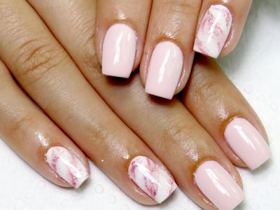 Advantages and disadvantages of nail implants